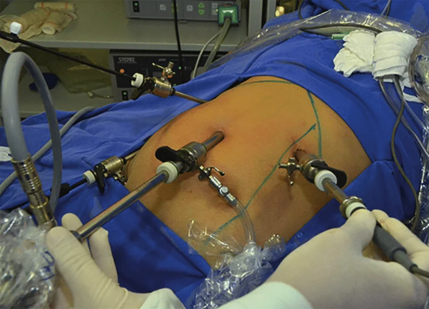 Gynecology